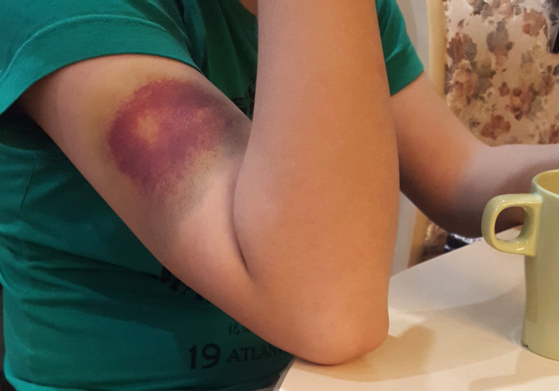 Странные игры