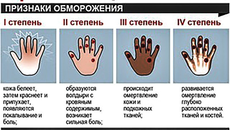 Отмороженные конечности можно спасти